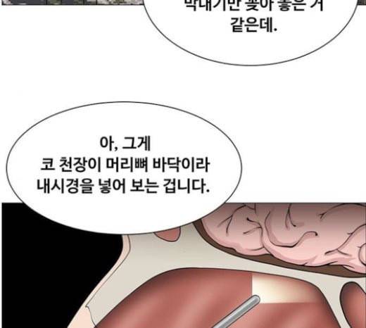 중증외상센터 골든 아워 21화 두개저 골절 56