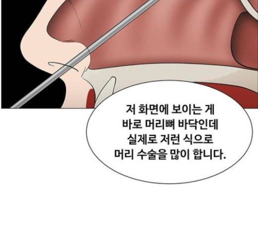 중증외상센터 골든 아워 21화 두개저 골절 57
