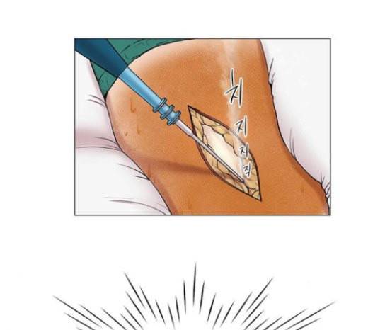 중증외상센터 골든 아워 21화 두개저 골절 83