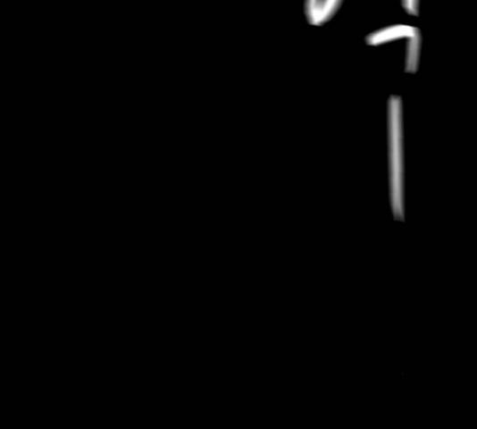 엽총소년 53화 11